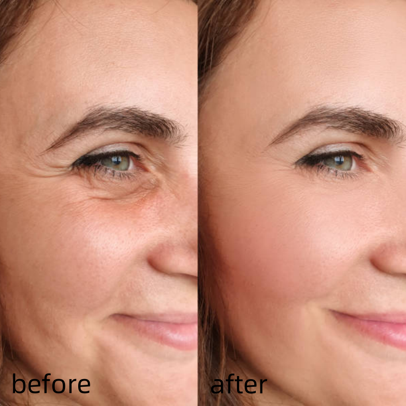 ✨50%OFF✨Cemenrete Calcium Multi Balm | Anti-aging, Sagging, Wrinkles | Korean Cosmetics💖(Buy3 & Free shipping)