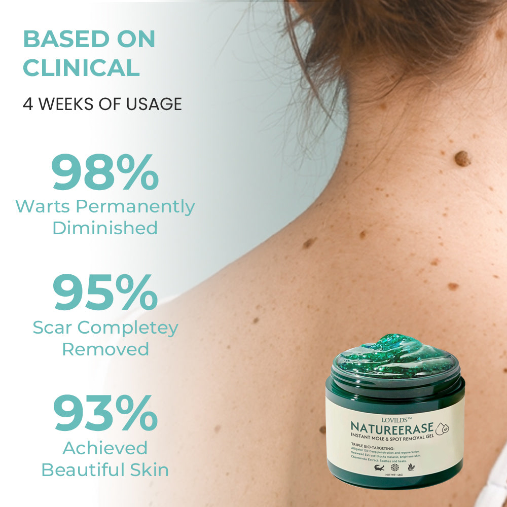 ✅ Official Store: LOVILDS™ NatureErase Instant Alligator Oil Mole & Spot Removal Plus Gel
