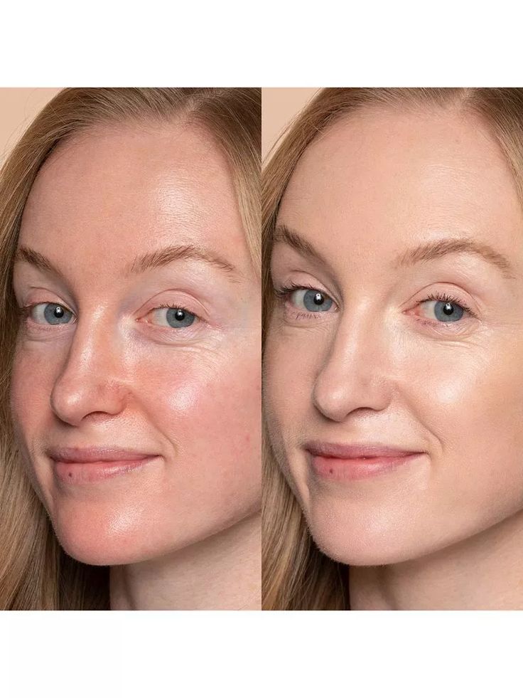 ✨✨LAST DAY 65 % OFF)ANTI-WRINKLE SKINCARE SET Eye Cream + Neck Cream-Perfect Duo